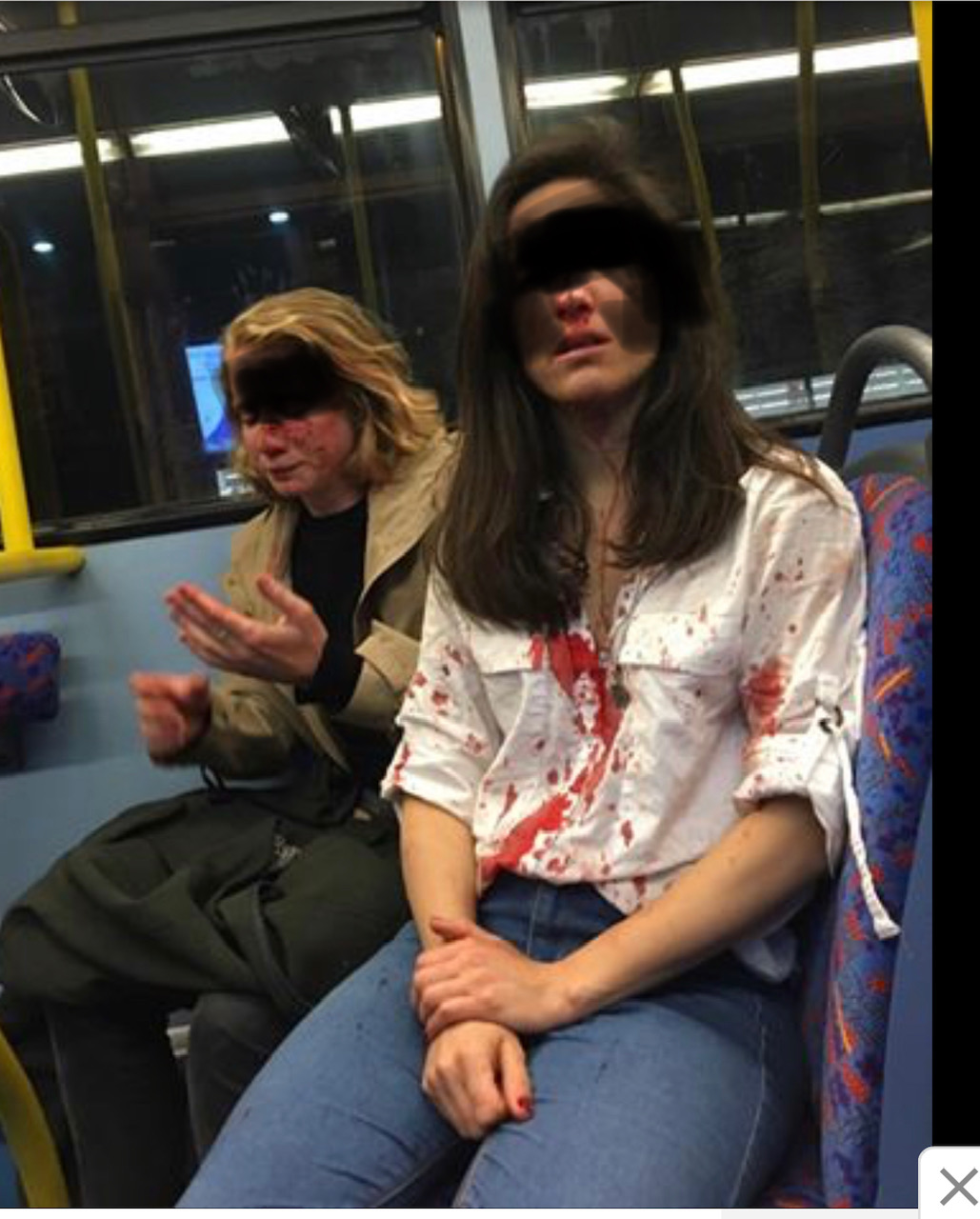 Brutal ataque homófobo y misógino en Londres